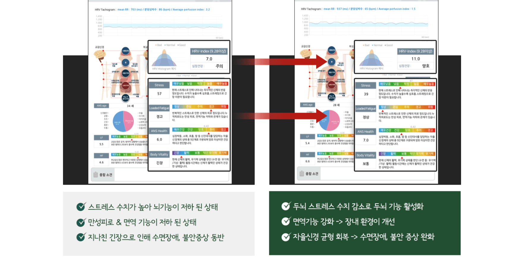脳波自律神経検査前後