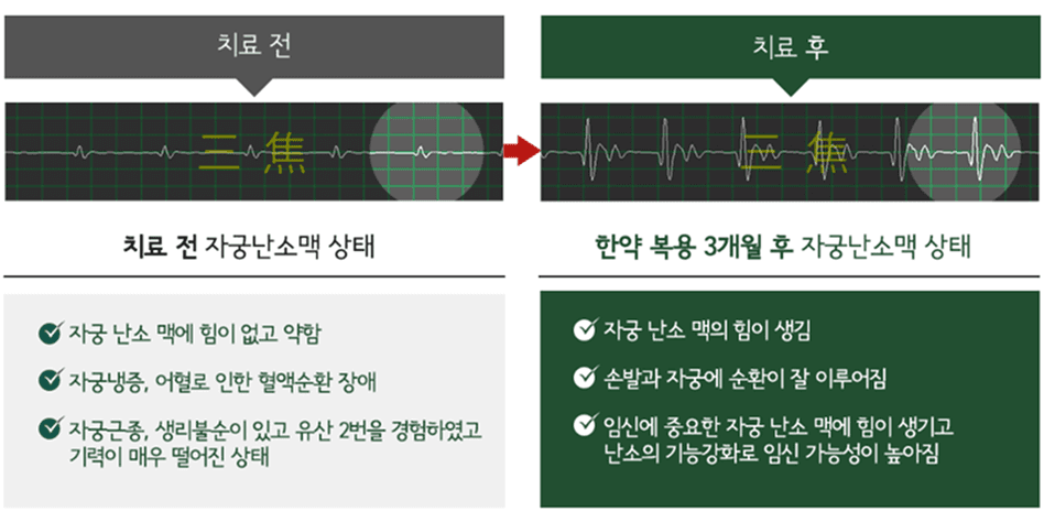 Pulse Wave Test Before/After (Pregnancy)