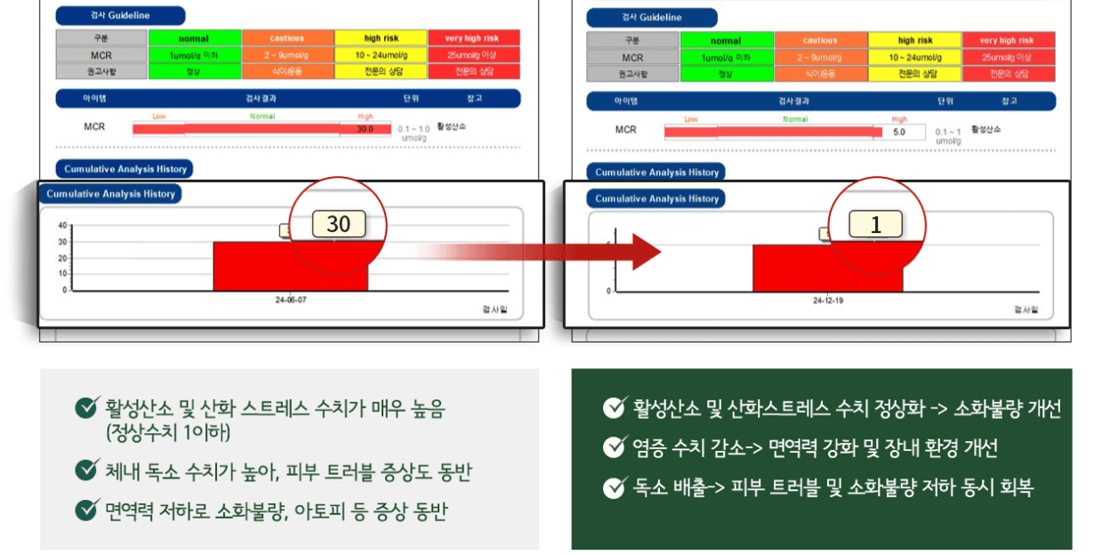 活性氧检查 前后(皮肤)