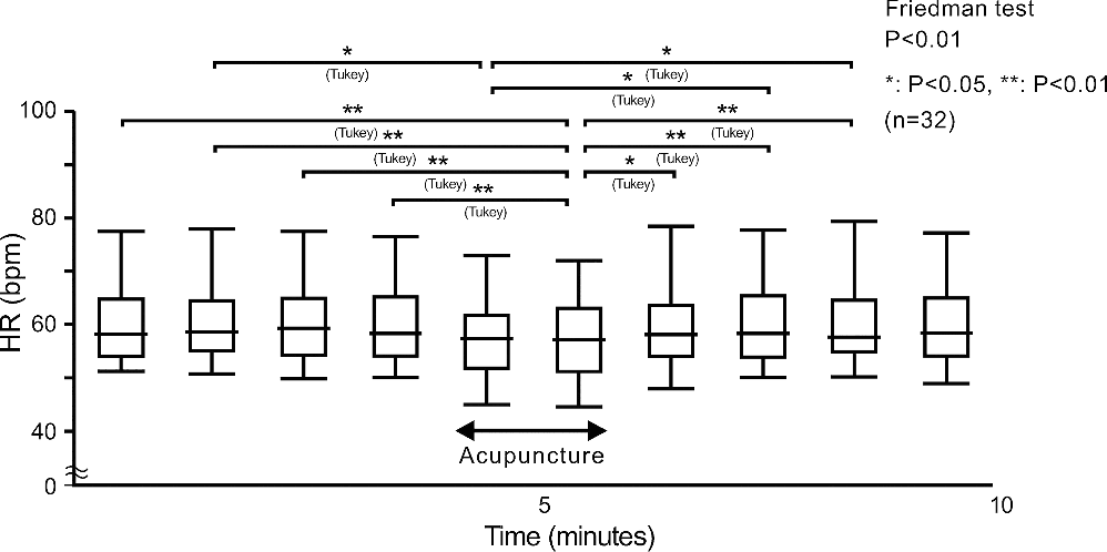 Effects of Acupuncture Sensations on Transient Heart Rate Reduction and Autonomic Nervous System Function